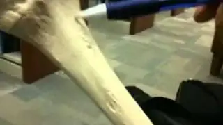 Tibia