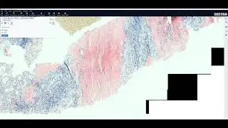 Congo Red Birefringence and Polarisation Whole Slide Image, scanner Zeiss Axioscan 7, viewer Sectra