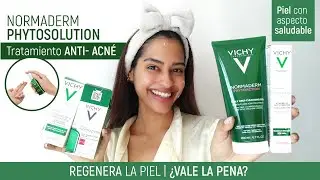 ¡NUEVO! Tratamiento Anti acné de Vichy Normaderm Phytosolutions | Luismarys Busek