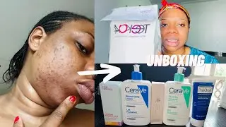 My FACE is Getting Worse| UNBOXING Skincare Products| Cerave Foaming Facial Cleanser.