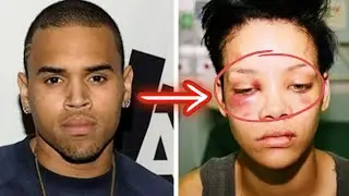 Disgusting Things Celebrities Do? Celebrity Mistakes 🤢