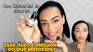 Melhor de Minoxidil -  Óleo  Essencial de Alecrim💫🌻