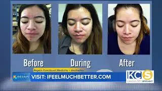 Regain Functional Medicine + Aesthetics - Facials in Kansas City (Oxygen Facial)