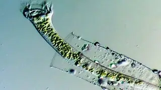 Vaginicola subcrystallina ( Vasentierchen ) Wimpertier ( Ciliat )
