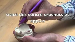 Etude de l'insertion en prothèse partielle amovible coulée