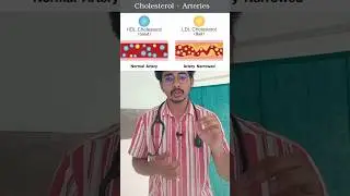 ❌Avoid Maida containing Foods❌ Dr.Mukesh #food #health #obesity #heart