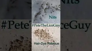 🔎 𝙆𝙣𝙤𝙬 𝙮𝙤𝙪𝙧 𝙚𝙣𝙚𝙢𝙮: 𝙉𝙞𝙩𝙨 𝙫𝙨. 𝙃𝙖𝙞𝙧 𝘿𝙮𝙚 𝘿𝙚𝙗𝙧𝙞𝙨. #petetheliceguy #lice