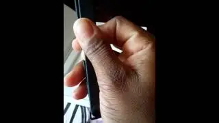 Misfit Shine Unboxing