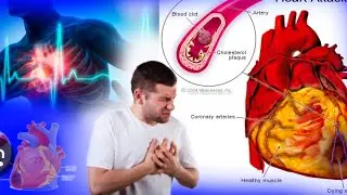 How does a heart attack occur? | 90% of people make this mistake | #heartanatomy #hearthealth #heart