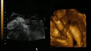 US 3D Parte II