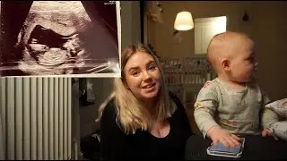JAG &Auml;R GRAVID!