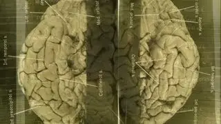 Images of Einstein's brain revealed