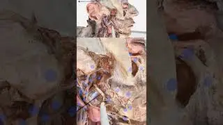 Study Human Anatomy: The Lingual Nerve