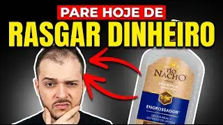 Shampoo Antiqueda Funciona Contra a Calv&iacute;cie? A VERDADE!