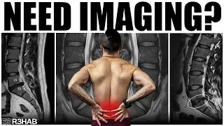 Low Back Pain & Imaging Myths (X-Rays, MRIs, Scans)