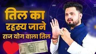 तिल बताता हैं महाराजयोग , Mole in palmistry