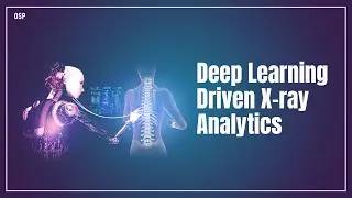 How Pneumonia is detected using Deep Learning Driven X-Ray Analytics