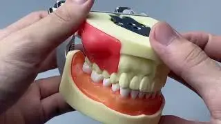 Dental Models for Patient Education,Caries Tooth Model Chinese customize,endodontics animal model