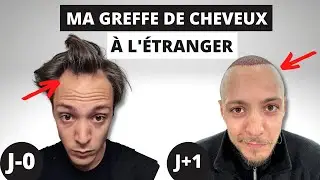 Les 7 Premiers jours de ma Greffe à l'étranger ✈️