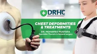 Non-Surgical Pectus Treatment Explained by Dr. Mustafa (Vacuum Bell Therapy and Brace)