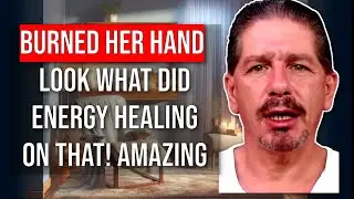 Energy Healing for SEVERE BURNS: 🔥 Fast & Painless Recovery! with Testimony