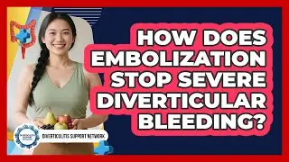 How Does Embolization Stop Severe Diverticular Bleeding? - Diverticulitis Support Network