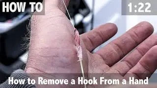 How to Remove a Hook from a Hand
