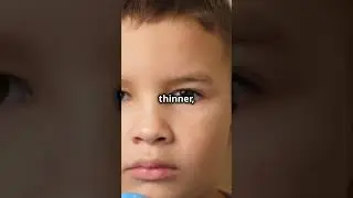 Why Do Some Kids Have Dark Circles Under Their Eyes? 🕶️👦👧