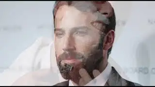 Experi&ecirc;ncia Dr. Laser | Design de barba com laser
