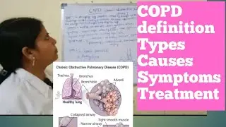 #COPD#Chronic obstructive pulmonary disease definition, types, causes, treatment,symptoms #@