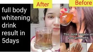 whitening drink only 3 ingredients | full body whitening drink | Skin Lightening Remedy in 7 Days