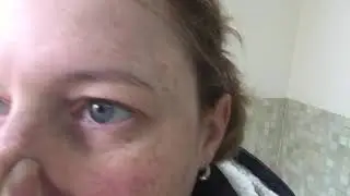 Blowing bubbles ... through tear ducts