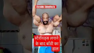 Steroids Side Effects #shorts #steroidsideeffects #supplements #bodybuilding #fitness #viral