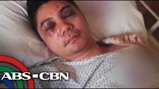 Bandila: Vhong Navarro undergoes reconstructive Surgery