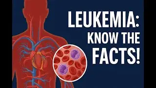 Leukemia: From Diagnosis to Treatment &mdash; The Complete Guide