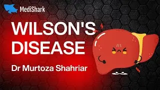 MRCP Theory: Wilson's Disease. Dr Murtoza Shahriar