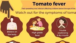 TOMATO FEVER SYMPTOMS