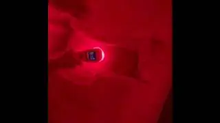 COLD LASER INFRARED LIGHT FREQUENCY THERAPY TREATMENT  |  PSORIASIS 