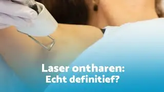 Is laser ontharen echt definitief?