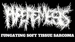HYPEREMESIS - FUNGATING SOFT TISSUE SARCOMA