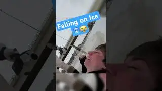 Мой первый перелом 🤕🦴