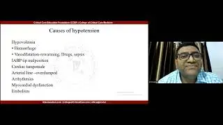 Post Cardiac Surgery Care in ICU Case Based discussion Dr Vivek Baxi