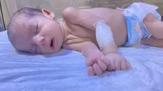 Cute Premature Baby in NICU | Recovering from RDS & ENNS with Formula Milk Feeding 🍼#neonatologist
