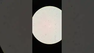 Lambert Bead Beating Symbiodinium Transformation 3