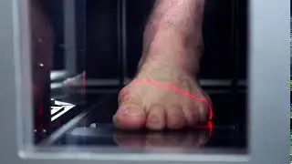 Prevolve - FootScan