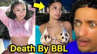 21 y/o Onlyfans Girl Dies After 3rd BBL Goes Bad