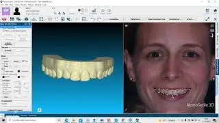 Demo NemoSmile 2021