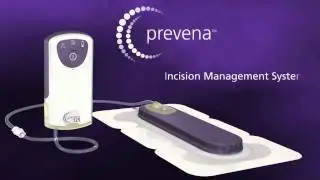 Prevena Incision Management System