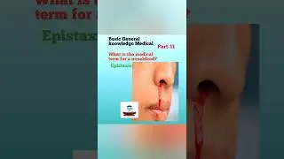 Epistaxis@FreeMedicalEducation-ld3sf#nursing#medical#mbbs#viralshorts#Viral#youtubeviralshorts