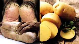 karab pauo kasy thek kary gy /Health and fitness 09 /